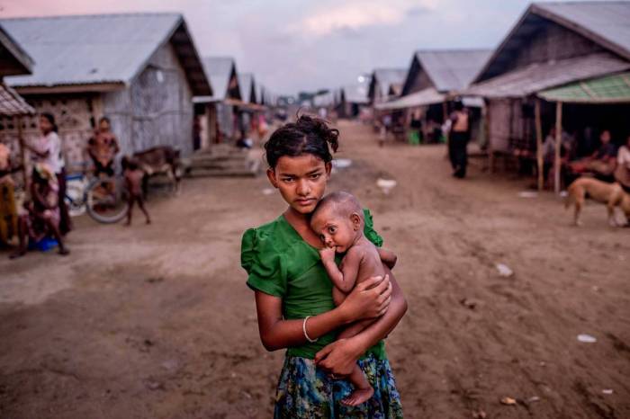 Oma Salema, 12, holds her undernourished brother Ayub Khan, 1, at a camp for Rohingya in Sittwe, Myanmar.